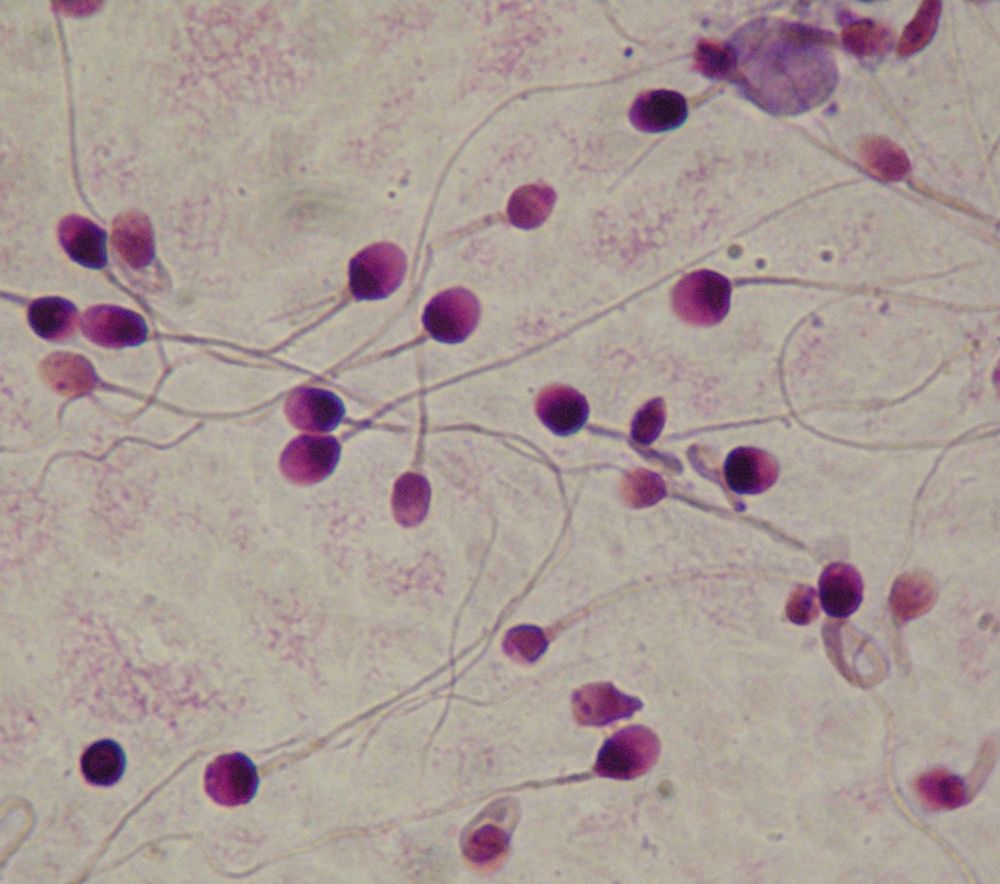 Taking Up a Collection